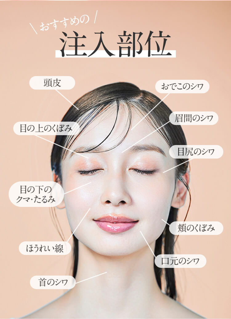 おすすめの注入部位