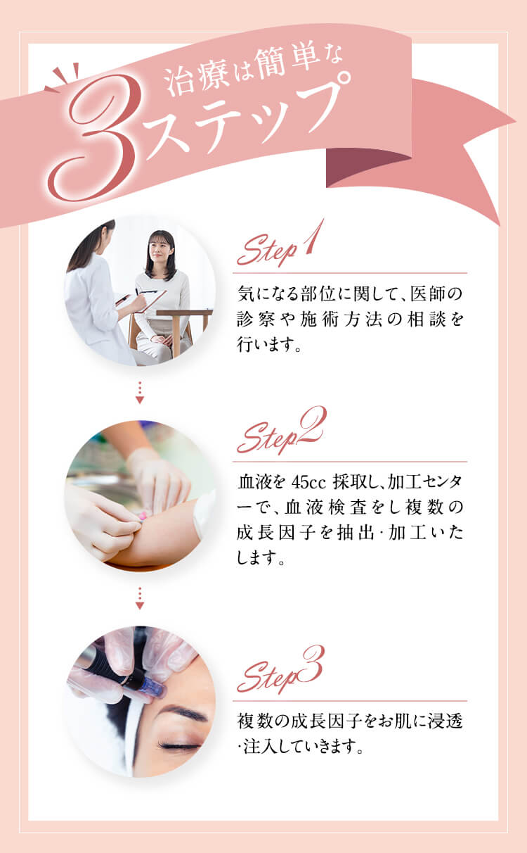 治療は簡単な3ステップ