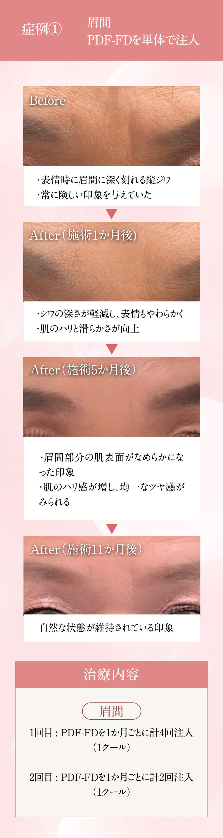 症例写真・ビフォーアフター