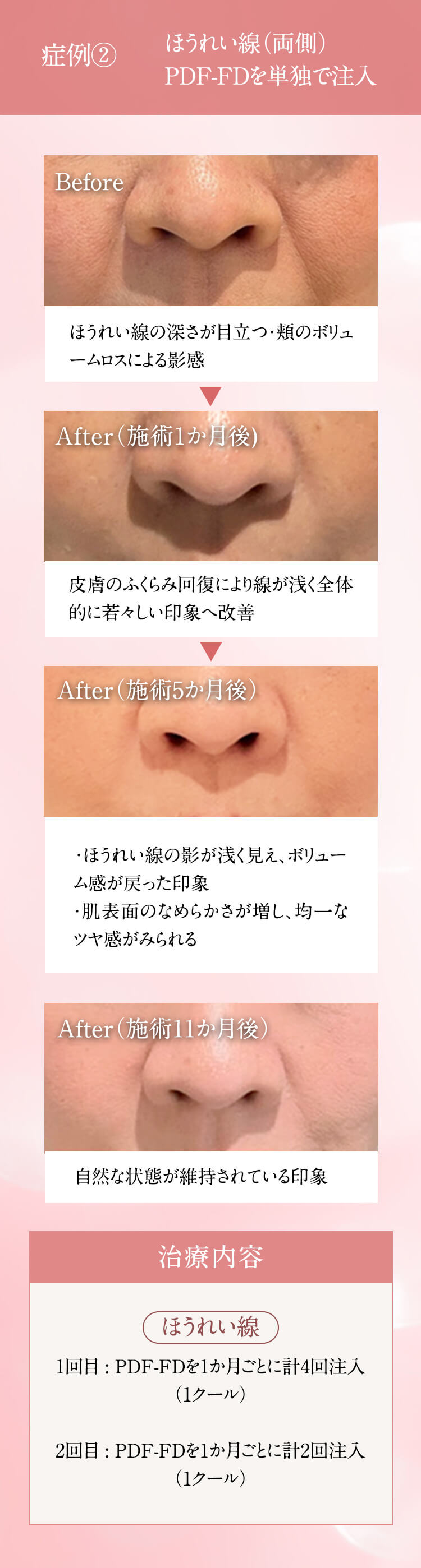 症例写真・ビフォーアフター